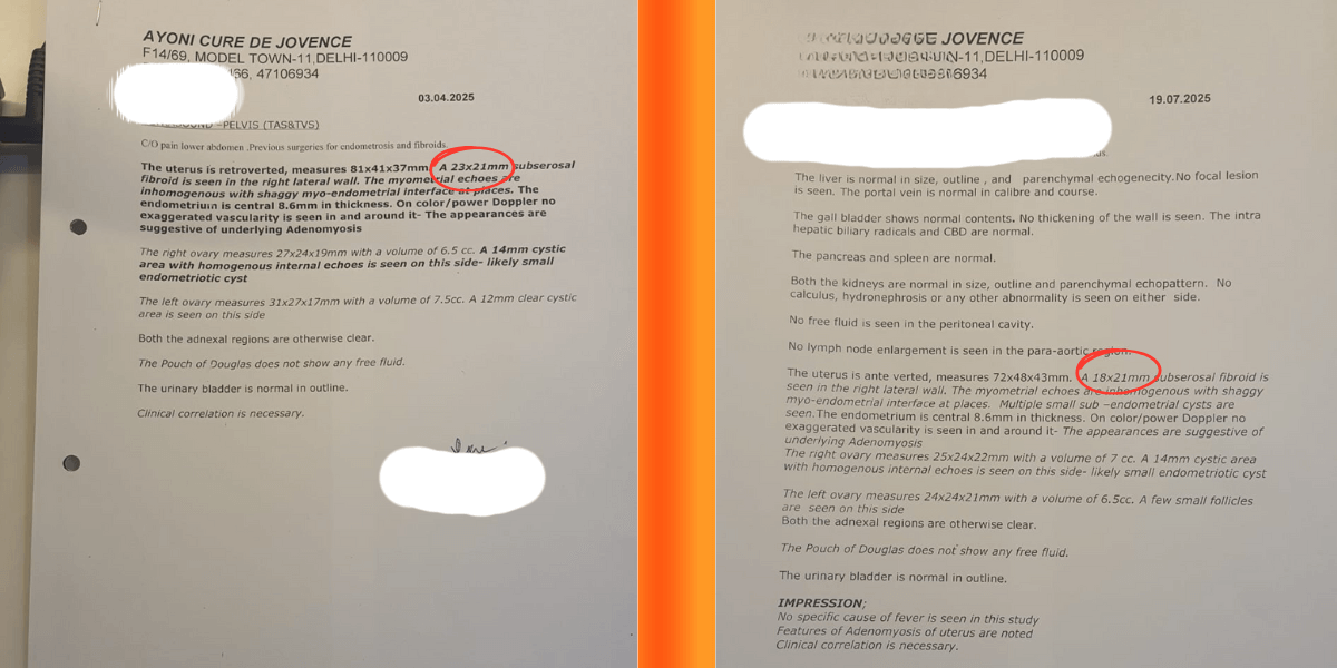 usg-reports-uterine fibroid-comparison